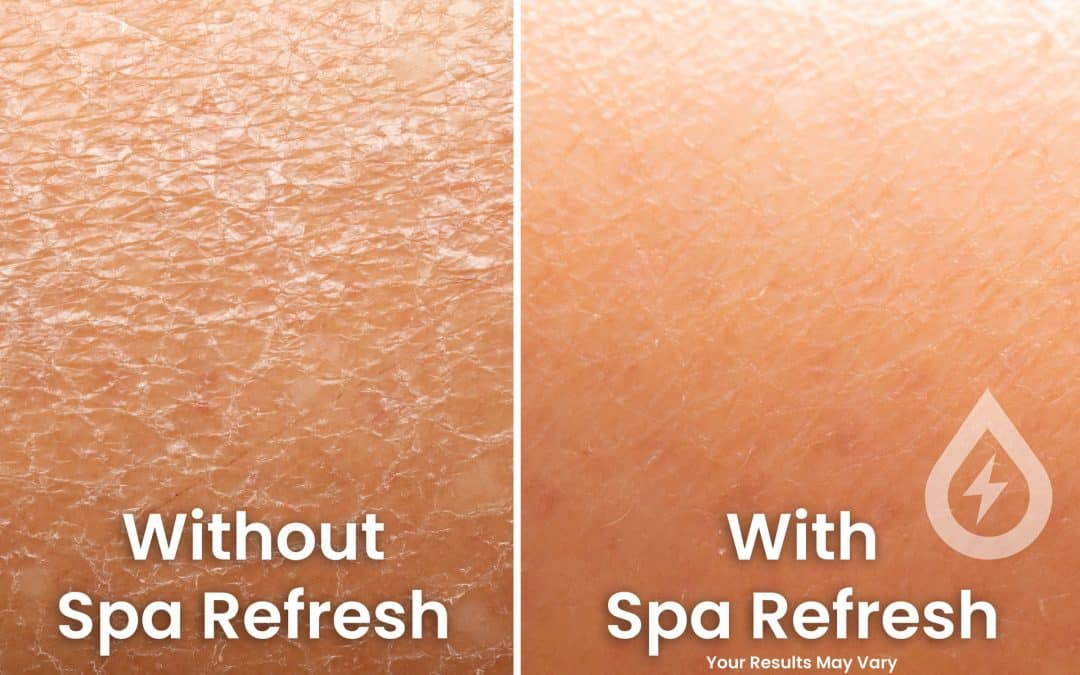 Introducing Pool and Spa Refresh: The Perfect Solution for Dry Skin After Swimming